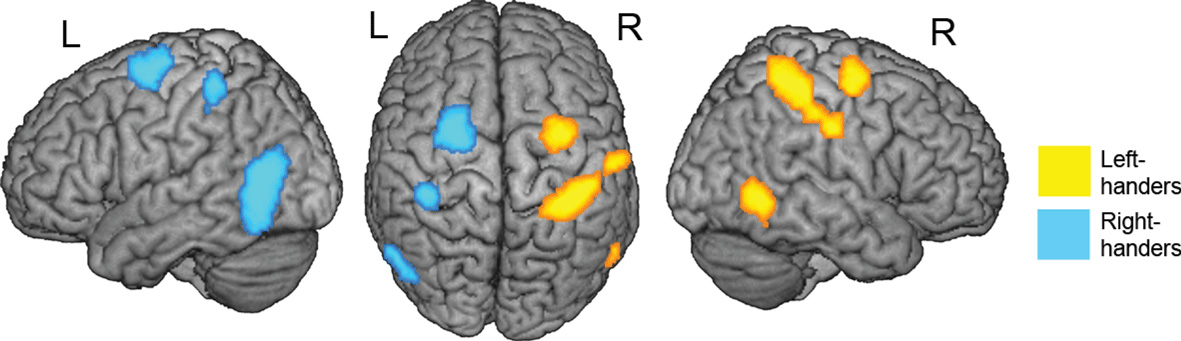 Figure 1 - Brain activation when participants imagined performing common hand actions.